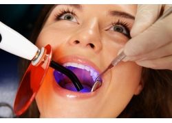 staking Kolibrie ring L'introduction et le développement de la lampe de polymérisation dentaire |  Fourniture du equipement dentaire et matériaux dentaires – dentairesmart.com